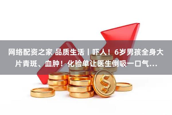 网络配资之家 品质生活丨吓人！6岁男孩全身大片青斑、血肿！化验单让医生倒吸一口气…